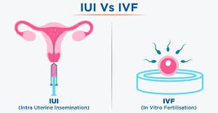 IUI vs IVF comparison